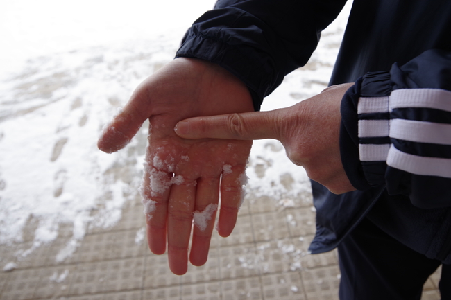 雪